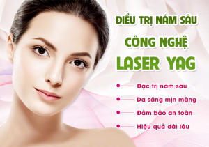 Điều trị tăng sắc ở da bằng laser Q YAG